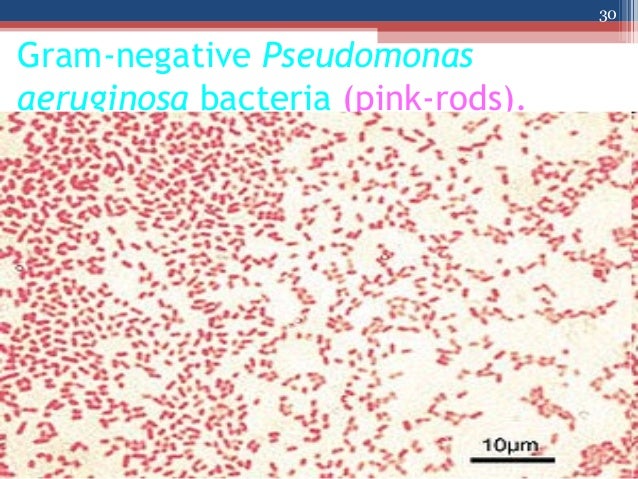 pseudomonas aeruginosa gram stain