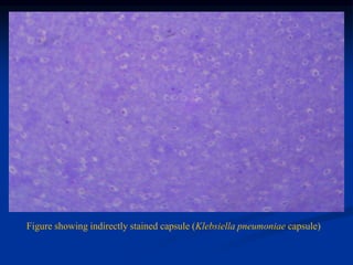 Figure showing indirectly stained capsule (Klebsiella pneumoniae capsule) 
 