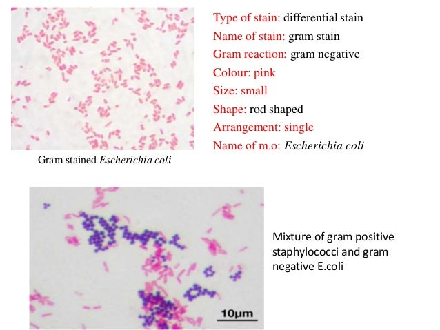 Bacterial Staining