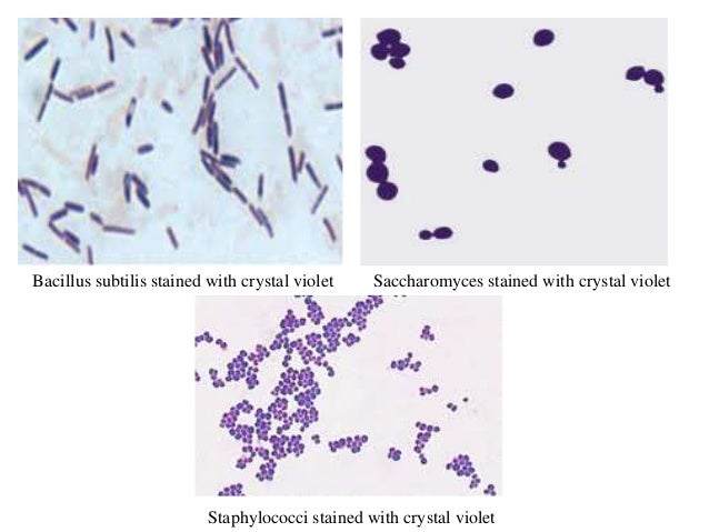 bacillus cereus gram stain
