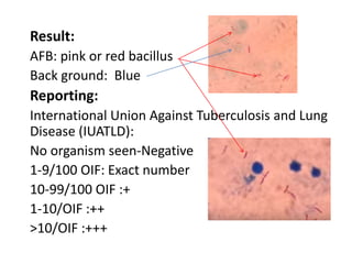 Result:
AFB: pink or red bacillus
Back ground: Blue
Reporting:
International Union Against Tuberculosis and Lung
Disease (IUATLD):
No organism seen-Negative
1-9/100 OIF: Exact number
10-99/100 OIF :+
1-10/OIF :++
>10/OIF :+++
 
