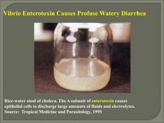 Rice-water stool of cholera. The A subunit of enterotoxin causes
epithelial cells to discharge large amounts of fluids and electrolytes.
Source: Tropical Medicine and Parasitology, 1995
Vibrio Enterotoxin Causes Profuse Watery Diarrhea
 