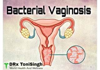 Bacterial vaginosis BV