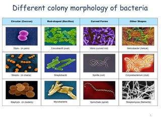 Different colony morphology of bacteria
5
 