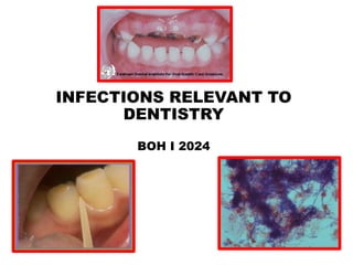 INFECTIONS RELEVANT TO
DENTISTRY
BOH I 2024
 