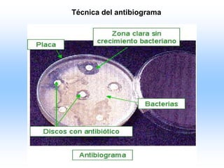 Bacterias