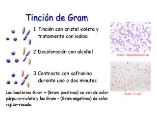 Gram + Staphylococcus sp.




      Gram - E. coli
 