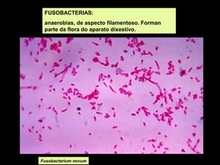 FUSOBACTERIAS:
anaerobias, de aspecto filamentoso. Forman
parte da flora do aparato dixestivo.

Fusobacterium novum

 
