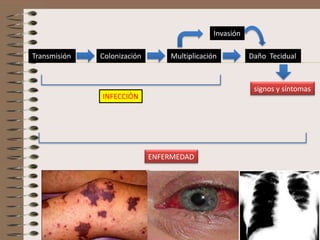Invasión

Transmisión   Colonización       Multiplicación          Daño Tecidual



                                                          signos y síntomas
              INFECCIÓN




                             ENFERMEDAD
 