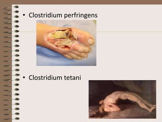 • Clostridium perfringens




• Clostridium tetani
 