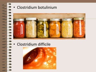 • Clostridium botulinium




• Clostridium difficile
 