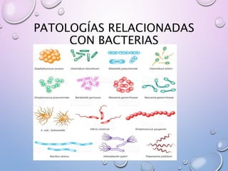 PATOLOGÍAS RELACIONADAS
CON BACTERIAS
 