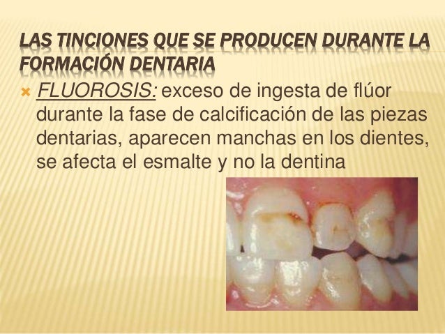 Las manchas de pigmento en las manos a los hombres