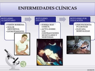 ENFERMEDADES CLÍNICAS

BOTULISMO             BOTULISMO            BOTULISMO POR
ALIMENTARIO           INFANTIL             INHALACIÓN

   • VISIÓN BORROSA      • FORMA MAS          • INSUFICIENCIA
   • DOLOR                 COMÚN.               PULMONAR
     ABDOMINAL           • ACTÚA SOBRE        • ELEVADA
   • ESTREÑIMIENTO         LAS                  MORTALIDAD
                           CONTRACCIONES
                           MUSCULARES Y
                           NERVIOSAS.
 
