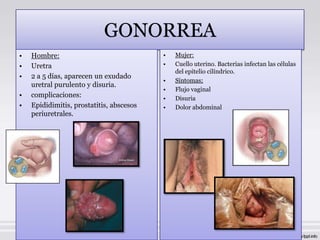 GONORREA
•   Hombre:                               •   Mujer:
•   Uretra                                •   Cuello uterino. Bacterias infectan las células
                                              del epitelio cilíndrico.
•   2 a 5 días, aparecen un exudado
                                          •   Síntomas;
    uretral purulento y disuria.
                                          •   Flujo vaginal
•   complicaciones:                       •   Disuria
•   Epididimitis, prostatitis, abscesos   •   Dolor abdominal
    periuretrales.
 