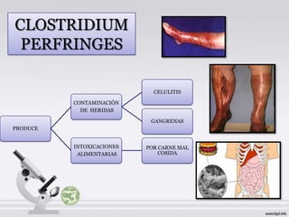 CLOSTRIDIUM
 PERFRINGES

                             CELULITIS

          CONTAMINACIÓN
            DE HERIDAS

                            GANGRENAS
PRODUCE


          INTOXICACIONES   POR CARNE MAL
           ALIMENTARIAS        COSIDA
 