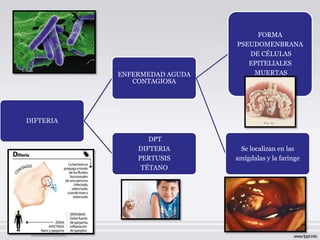 FORMA
                              PSEUDOMENBRANA
                                 DE CÉLULAS
                                 EPITELIALES
           ENFERMEDAD AGUDA       MUERTAS
              CONTAGIOSA




DIFTERIA

                  DPT
               DIFTERIA        Se localizan en las
               PERTUSIS       amígdalas y la faringe
                TÉTANO
 
