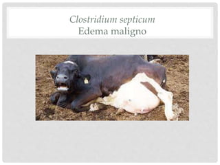 Clostridium septicum
Edema maligno
 