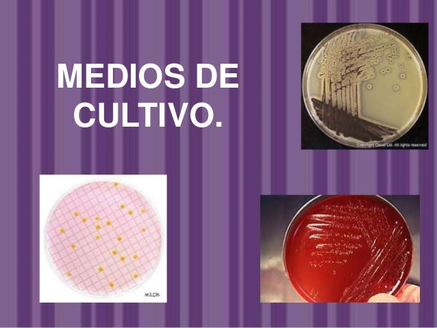 Bacterias gram positivas