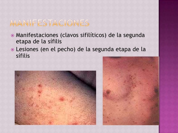 La crema para la corrección de la forma del pecho meytan