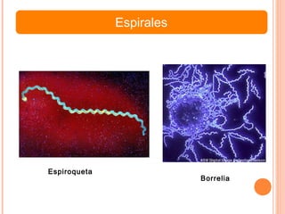Espirales
Espiroqueta
Borrelia
 