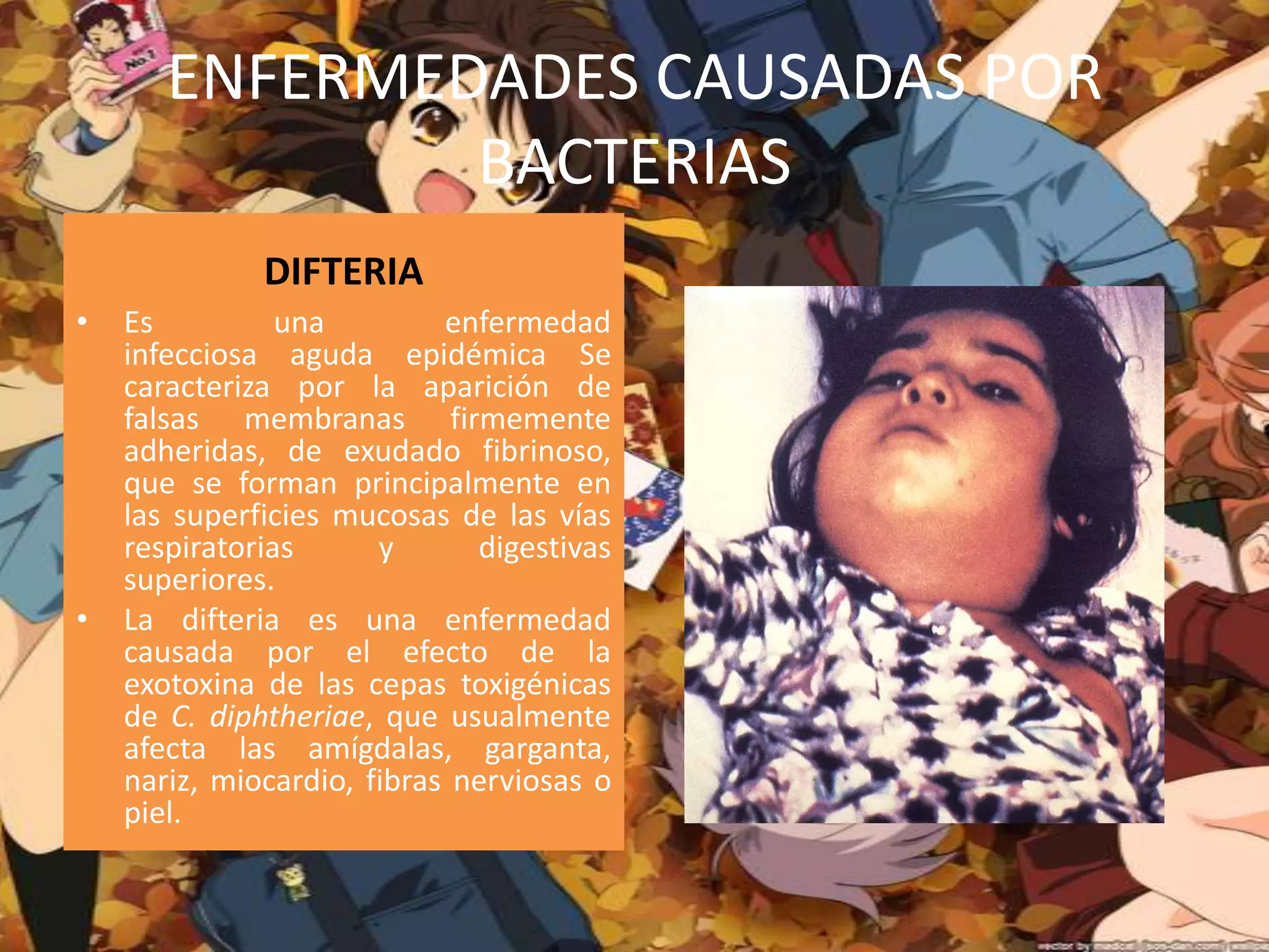 ENFERMEDADES CAUSADAS POR BACTERIAS DIFTERIAEs una enfermedad infecciosa aguda epidémica Se caracteriza por la aparición de falsas membranas firmemente adheridas, de exudado fibrinoso, que se forman principalmente en las superficies mucosas de las vías respiratorias y digestivas superiores.La difteria es una enfermedad causada por el efecto de la exotoxina de las cepas toxigénicas de C. diphtheriae, que usualmente afecta las amígdalas, garganta, nariz, miocardio, fibras nerviosas o piel.