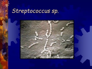 Streptococcus sp.
 