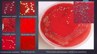 Actinomyces israelii Propionibacterium acnes
Finegoldia magna
Veillonella parvula
Bacteroides fragilis
Fusobacterium nucleatum Prelevements pathologisques cultivés sous anaerobiose
 