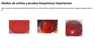 Medios de cultivo y pruebas bioquímicas importantes:
Agar sangre más ácida de sodio (alfa hemolíticas o no hemolíticas), donde crecen colonias mucoides o rugosas después de 48
h.
 