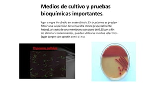 Medios de cultivo y pruebas
bioquímicas importantes:
Agar sangre incubado en anaerobiosis. En ocaciones es preciso
filtrar una suspensión de la muestra clínica (especialmente
heces), a través de una membrana con poro de 0,65 µm a fin
de eliminar contaminantes, pueden utilizarse medios selectivos
(agar sangre con spectin o m i c i n a
 