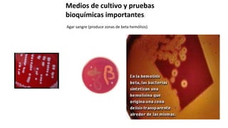 Medios de cultivo y pruebas
bioquímicas importantes:
Agar sangre (produce zonas de beta hemólisis).
 