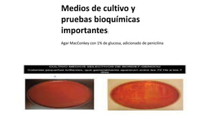 Medios de cultivo y
pruebas bioquímicas
importantes:
Agar MacConkey con 1% de glucosa, adicionado de penicilina
 
