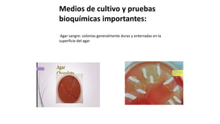 Medios de cultivo y pruebas
bioquímicas importantes:
Agar sangre: colonias generalmente duras y enterradas en la
superficie del agar
 