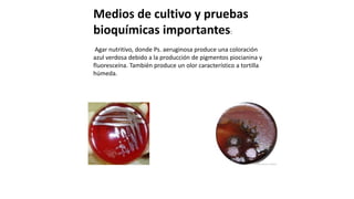 Medios de cultivo y pruebas
bioquímicas importantes:
Agar nutritivo, donde Ps. aeruginosa produce una coloración
azul verdosa debido a la producción de pigmentos piocianina y
fluoresceína. También produce un olor característico a tortilla
húmeda.
 