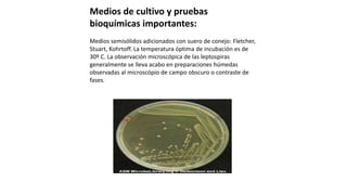 Medios de cultivo y pruebas
bioquímicas importantes:
Medios semisólidos adicionados con suero de conejo: Fletcher,
Stuart, Kohrtoff. La temperatura óptima de incubación es de
30º C. La observación microscópica de las leptospiras
generalmente se lleva acabo en preparaciones húmedas
observadas al microscópio de campo obscuro o contraste de
fases.
 