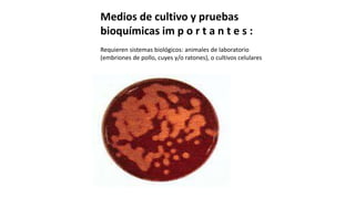 Medios de cultivo y pruebas
bioquímicas im p o r t a n t e s :
Requieren sistemas biológicos: animales de laboratorio
(embriones de pollo, cuyes y/o ratones), o cultivos celulares
 