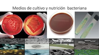 Medios de cultivo y nutrición bacteriana
 