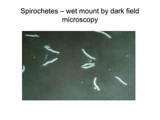 Spirochetes – wet mount by dark field 
microscopy 
 