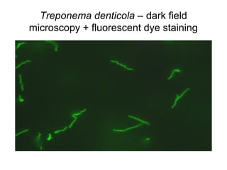 Treponema denticola – dark field 
microscopy + fluorescent dye staining 
 