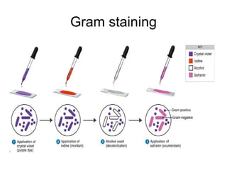 Gram staining 
 