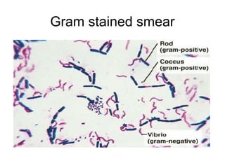 Gram stained smear 
 