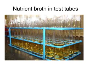 Nutrient broth in test tubes 
 