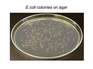 E.coli colonies on agar 
 