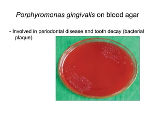 Porphyromonas gingivalis on blood agar 
- Involved in periodontal disease and tooth decay (bacterial 
plaque) 
 