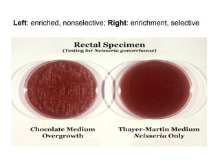 Left: enriched, nonselective; Right: enrichment, selective 
 