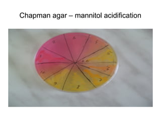 Chapman agar – mannitol acidification 
 