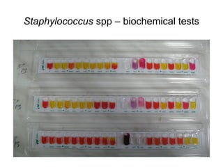 Staphylococcus spp – biochemical tests 
 