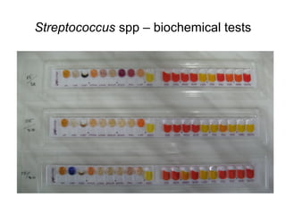 Streptococcus spp – biochemical tests 
 