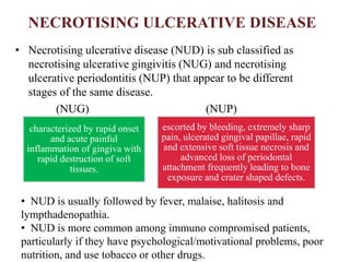 NECROTISING ULCERATIVE DISEASE
• Necrotising ulcerative disease (NUD) is sub classified as
necrotising ulcerative gingivitis (NUG) and necrotising
ulcerative periodontitis (NUP) that appear to be different
stages of the same disease.
(NUG) (NUP)
escorted by bleeding, extremely sharp
pain, ulcerated gingival papillae, rapid
and extensive soft tissue necrosis and
advanced loss of periodontal
attachment frequently leading to bone
exposure and crater shaped defects.
characterized by rapid onset
and acute painful
inflammation of gingiva with
rapid destruction of soft
tissues.
• NUD is usually followed by fever, malaise, halitosis and
lympthadenopathia.
• NUD is more common among immuno compromised patients,
particularly if they have psychological/motivational problems, poor
nutrition, and use tobacco or other drugs.
 