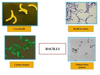 Coccobacilli Bacilli in chains
Comma shaped Chinese letter
pattern
BACILLI
 